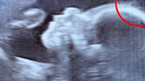 Az orvos furcsa dolgot észlelt az ultrahangos képen
