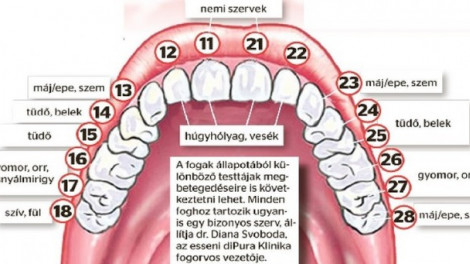 Ha romlik a fogad, valójában a hozzá tartozó szerveddel van baj!