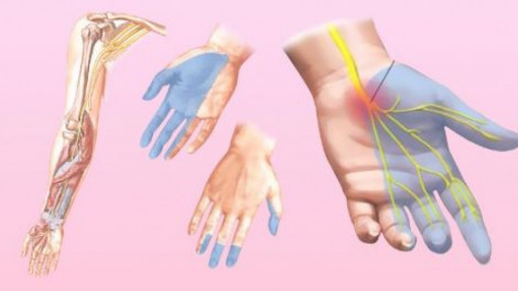 Az ujjaid zsibbadása az egészségi állapotodra utal  
