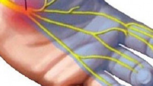 Hét dolog, ami miatt zsibbadhat a kezed